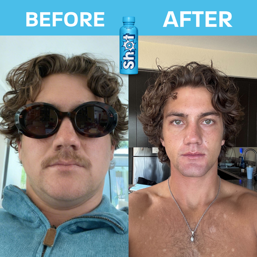 Sure Shot 4-Pack Liver Support & Detox